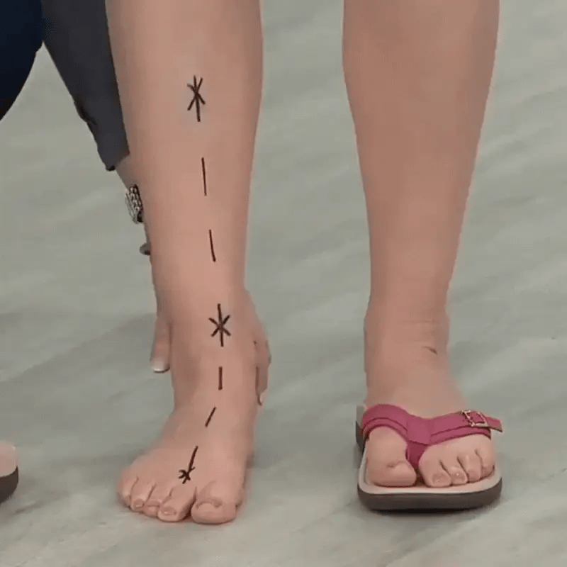 Nelly | Orthopädische Sommersandalen für ultimativen Komfort